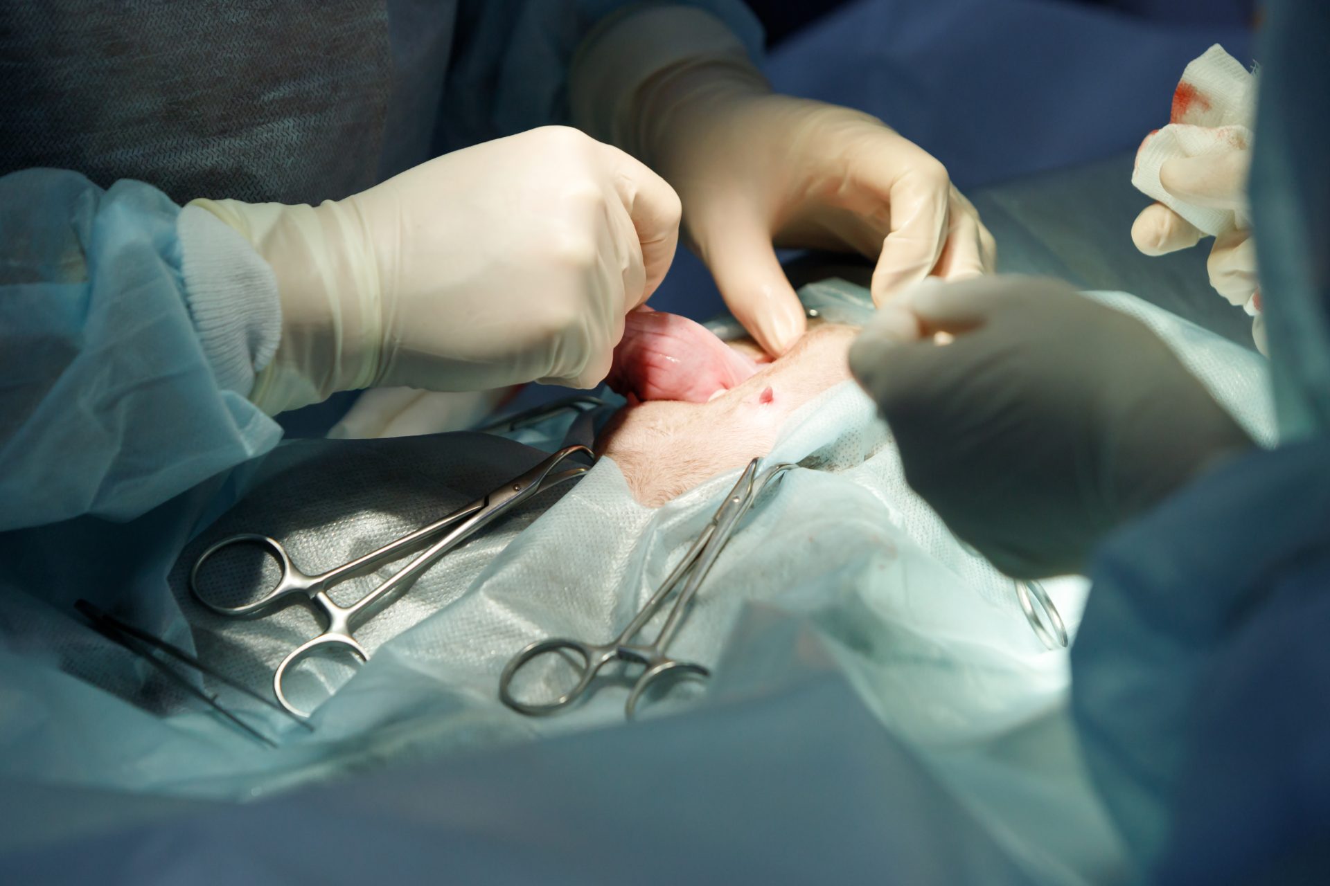 parto cesareo programmato